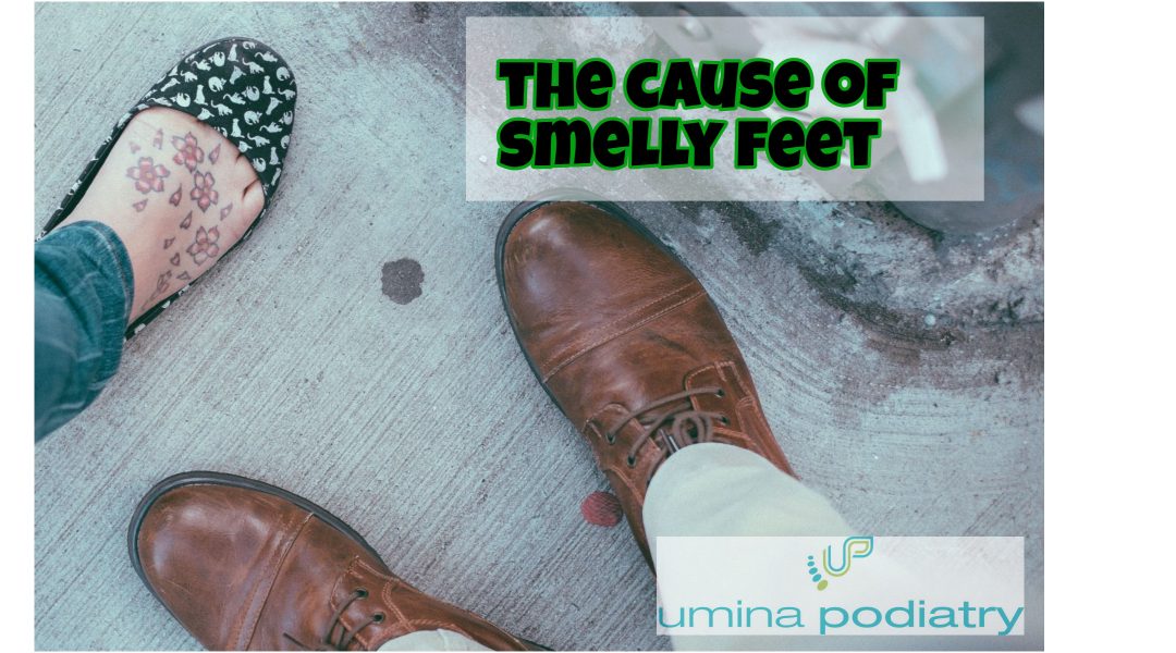 The Cause of Smelly Feet